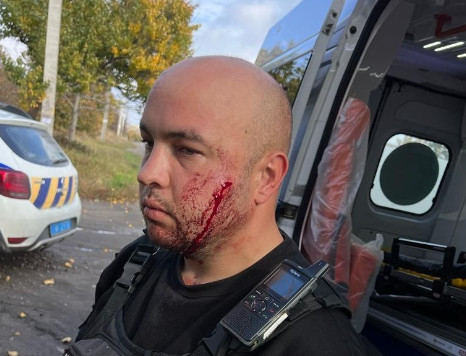 Напав на поліцейського з ножем, поранив його та себе: затримали мешканця Дніпропетровщини