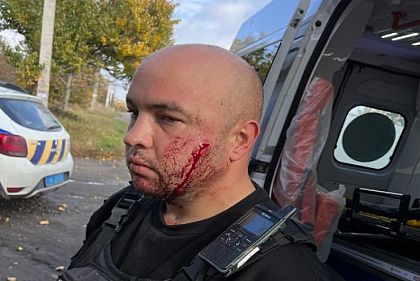 Напал на полицейского с ножом, ранил его и себя: задержали жителя Днепропетровщины