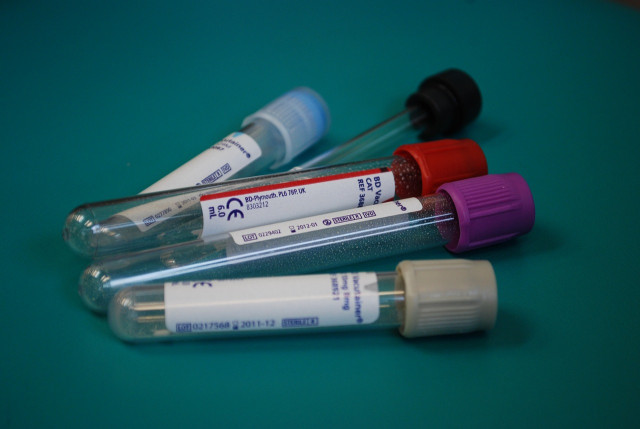 В медучреждения Днепропетровщины доставлены антиген-тесты для определения COVID-19