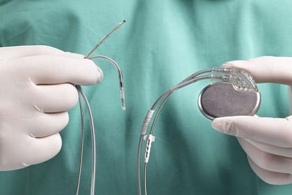 В 2022 году в Днепропетровской области бесплатно установили 750 кардиостимуляторов