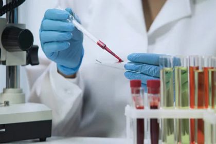 В Минздраве опровергли информацию о введении карантина из-за вспышки гепатита А