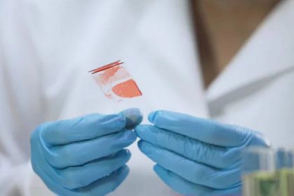 В Кривом Роге выявили случай гепатита А