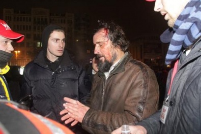 Минздрав сообщил о количестве травмированных и отсутствии погибших в Киеве (ИСПРАВЛЕНО)