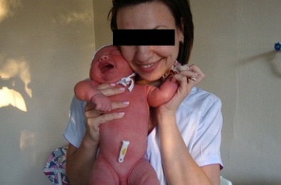 В Днепропетровске две медсестры устроили фотосессию с недоношенными младенцами