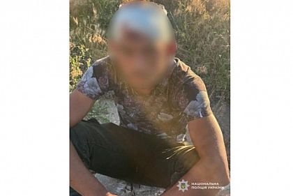 Подвійний удар ножем: у Кривому Розі затримали підозрюваного в нападі