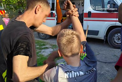 Напоровся рукою на металевий штир: як на Дніпропетровщині рятували хлопчика