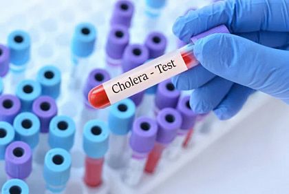 В Україні стартував посилений нагляд за холерою: що це означає
