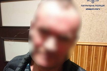 Фейковий виклик поліції у Кривому Розі: чоловіка оштрафували на 850 гривень
