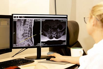 КТ та МРТ безкоштовно: у скількох медзакладах Дніпропетровщини можна пройти обстеження