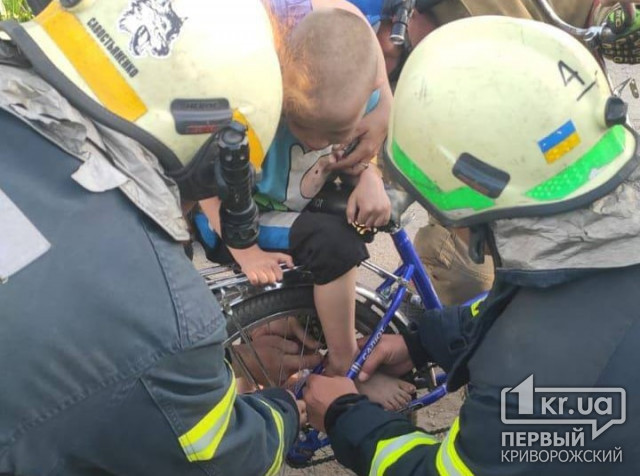 Криворізькі рятувальники допомогли дитині витягти ногу зі спиць велосипеда