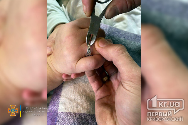 В Кривом Роге спасатели помогли женщине снять кольцо с пальца