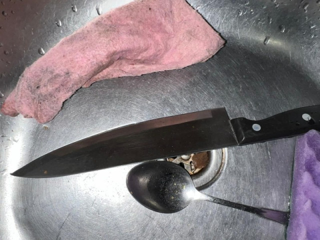 У Криворізькому районі поліцейські затримали чоловіка за нанесення ножового поранення знайомому