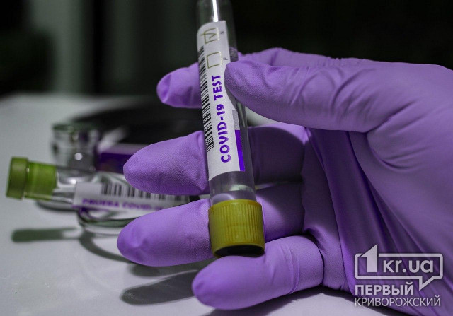 666 новых случаев коронавируса зафиксировали в Украине за прошедшие сутки