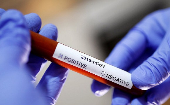 В Україні з’явилася тест-система для виявлення китайського коронавірусу