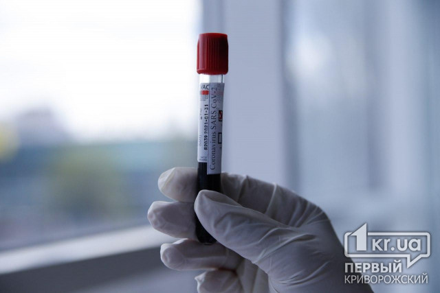 За сутки в Украине коронавирус обнаружили у 4 тысяч 348 человек