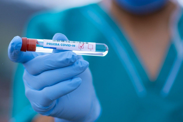 Еще шесть случаев коронавируса зарегистрировали в Кривом Роге