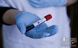 Кривой Рог опережает США в ПЦР-тестировании на коронавирус, - заявление чиновников