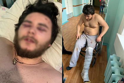 Под домашний арест поместили подозреваемых в избиении и похищении криворожанина