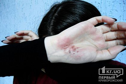 Более 1000 криворожан состоят на учете за совершение домашнего насилия