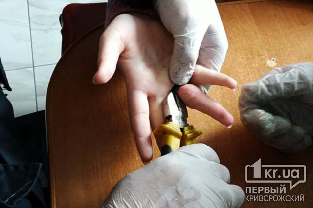 Пожарные болгаркой разрезали кольцо, застрявшее на пальце ребенка