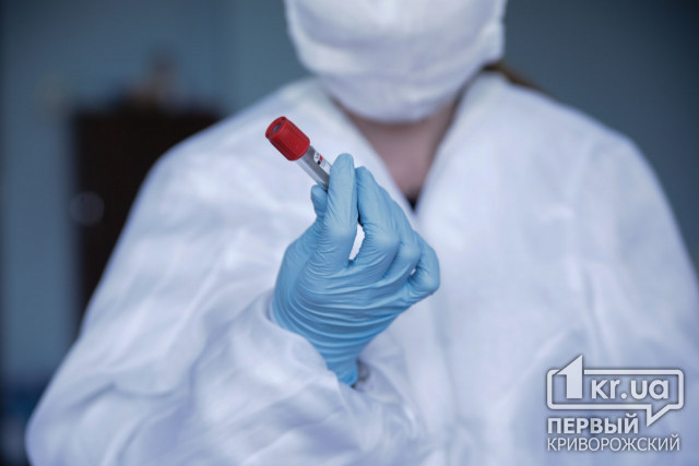 Еще один случай коронавируса в Кривом Роге подтвердила областная лаборатория