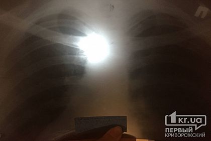 Ремонт томографа в противотуберкулезном диспансере обойдется почти в 3 миллиона гривен