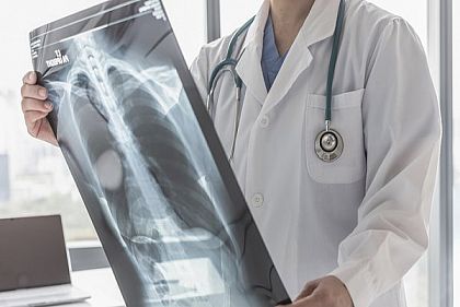 На Криворожье снизилось заболевание туберкулезом