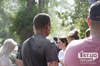 9 погибших и 29 раненых: последствия ракетного удара по Кривому Рогу: ОБНОВЛЕНО