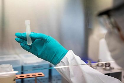 Как уберечь себя от холеры: советы от МОЗ