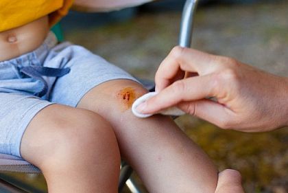 Как распознать симптомы столбняка: советы от МОЗ