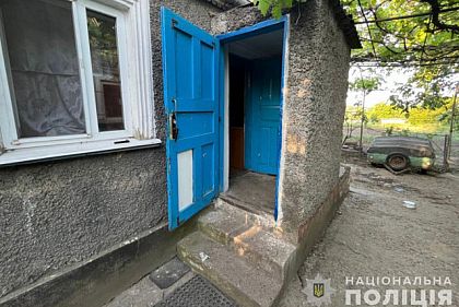 Поджег знакомого во время ссоры: в Кривом Роге задержали подозреваемого