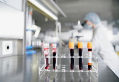 Скандал в медицине: уже проверенная донорская кровь может быть заражена