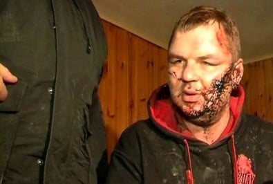 Активиста Автомайдана нашли измученным под Киевом