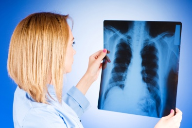 В Днепропетровской области снизился уровень заболеваемости туберкулезом