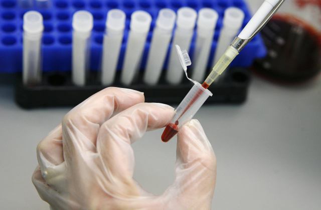 У Кривому Розі відбудеться Європейський тиждень безкоштовного тестування на ВІЛ (РОЗКЛАД)
