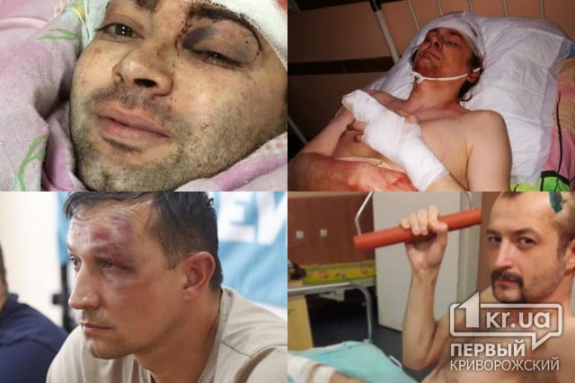Несколько дел, касающихся нападений на депутатов и активистов в Кривом Роге, передали в Главное следственное управление Украины