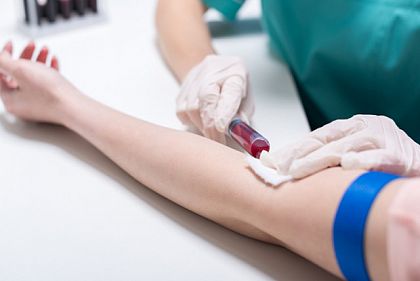 Жителям Днепропетровщины напомнили, где бесплатно протестоваться на ВИЧ