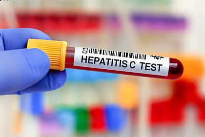 Кому из криворожан нужно ежегодно тестироваться на вирусные гепатиты