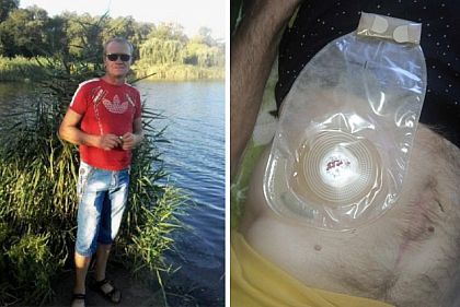 Криворожан просят присоединиться к сбору на лечение онкобольного горожанина