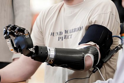 Днепропетровщина занимает второе место по количеству полученных протезов