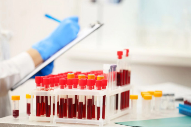 Как криворожанам бесплатно узнать группу крови