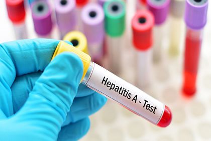 Сколько случаев гепатита А зафиксировали в Кривом Роге в этом году