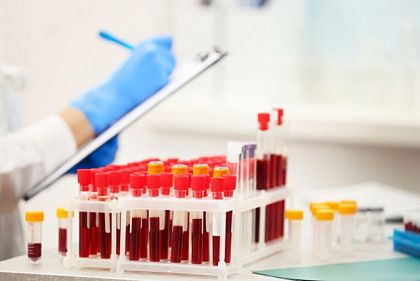 Как криворожанам бесплатно узнать группу крови