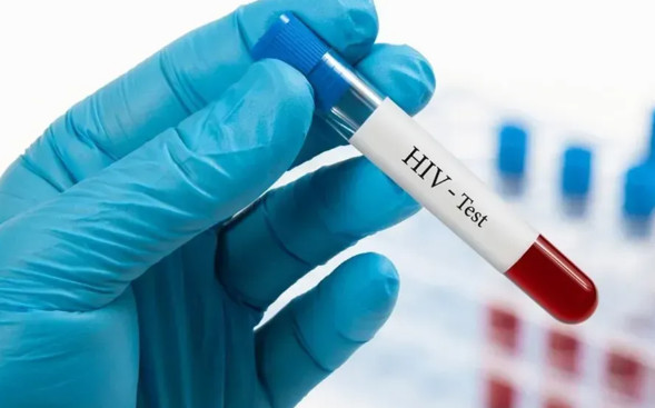 В квітні в Україні зареєстрували 696 нових випадків ВІЛ-інфекції В квітні в Україні зареєстрували 696 нових випадків ВІЛ-інфекції