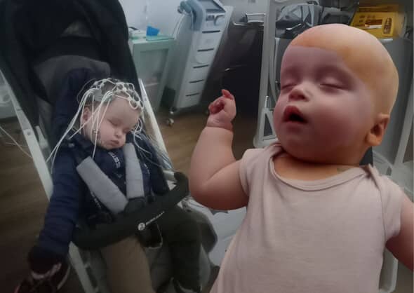 волонтеры собирают средства на лечение ребенка из Кривого Рога лечение ребёнка
