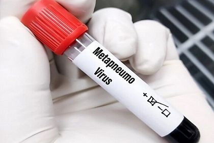 На прошлой неделе у жителя Днепропетровщины обнаружили метапневмовирус