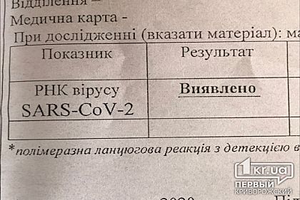 В Украине снизилось суточное количество тестирований на коронавирус