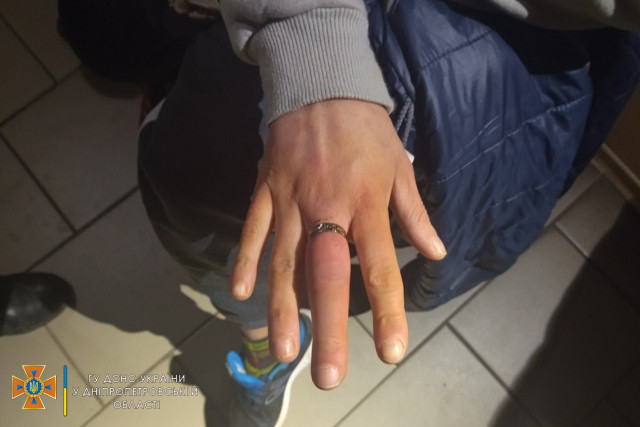 Криворожские спасатели помогли женщине снять кольцо