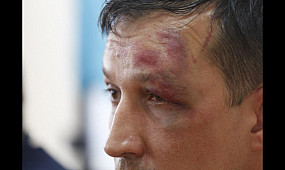 Происшествие: В Кривом Роге напали на депутата | 1kr.ua